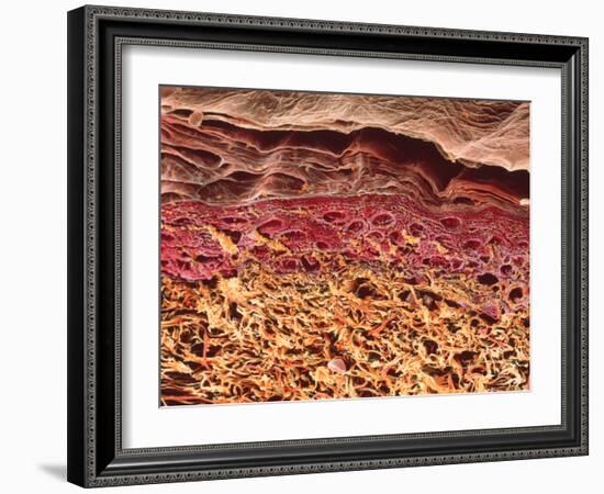 SEM of Section Through Human Skin-Steve Gschmeissner-Framed Photographic Print