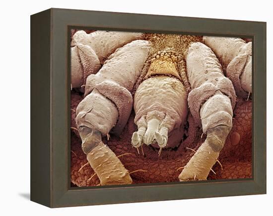 Sheep Tick, SEM-Steve Gschmeissner-Framed Premier Image Canvas