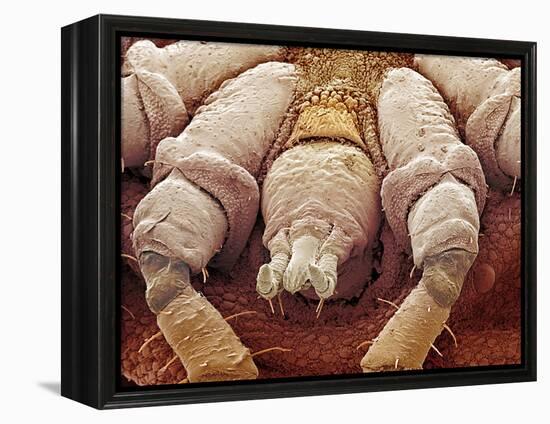 Sheep Tick, SEM-Steve Gschmeissner-Framed Premier Image Canvas