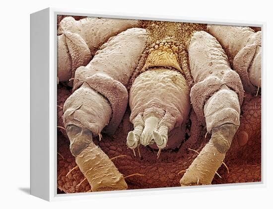 Sheep Tick, SEM-Steve Gschmeissner-Framed Premier Image Canvas