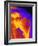 Shoulder Joint X-ray-PASIEKA-Framed Photographic Print