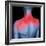 Shoulder Pain, Conceptual Artwork-David Mack-Framed Premium Photographic Print