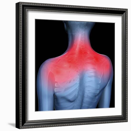 Shoulder Pain, Conceptual Artwork-David Mack-Framed Premium Photographic Print