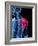 Shoulder Pain, Conceptual Artwork-SCIEPRO-Framed Photographic Print