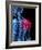 Shoulder Pain, Conceptual Artwork-SCIEPRO-Framed Photographic Print