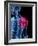 Shoulder Pain, Conceptual Artwork-SCIEPRO-Framed Photographic Print