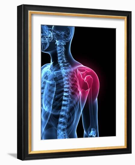 Shoulder Pain, Conceptual Artwork-SCIEPRO-Framed Photographic Print