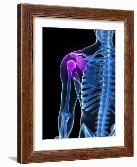 Shoulder Pain, Conceptual Artwork-SCIEPRO-Framed Photographic Print