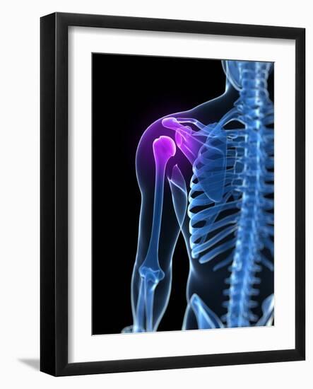 Shoulder Pain, Conceptual Artwork-SCIEPRO-Framed Photographic Print