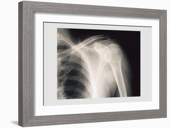 Shoulder-null-Framed Premium Giclee Print