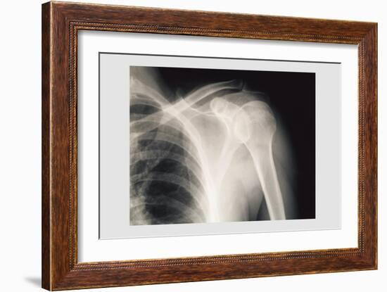 Shoulder-null-Framed Premium Giclee Print