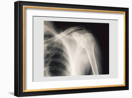 Shoulder-null-Framed Premium Giclee Print