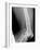 Shrapnel Injury, X-ray-Du Cane Medical-Framed Photographic Print