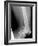 Shrapnel Injury, X-ray-Du Cane Medical-Framed Photographic Print
