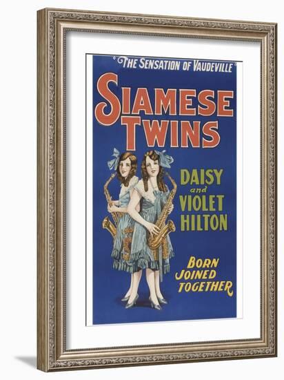 Siamese Twins-null-Framed Art Print