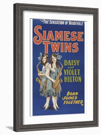 Siamese Twins-null-Framed Art Print