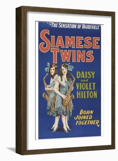 Siamese Twins--Framed Art Print