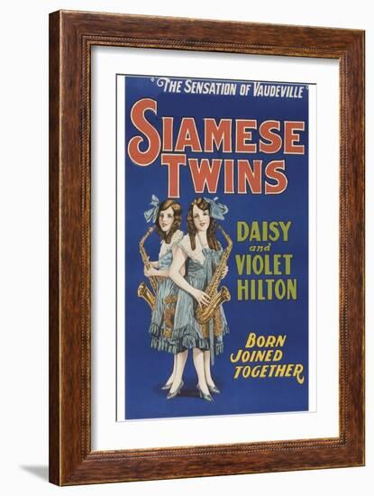 Siamese Twins-null-Framed Art Print