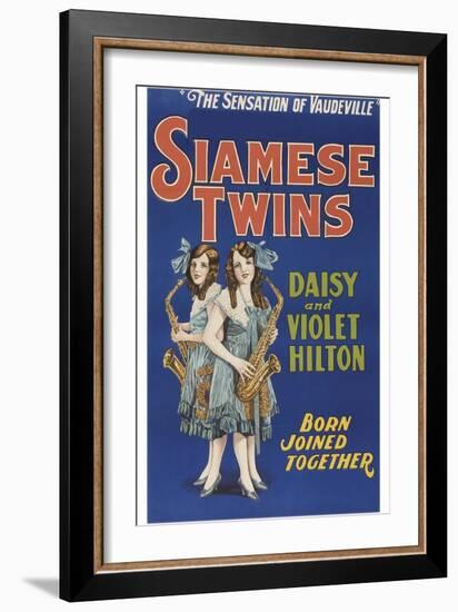 Siamese Twins-null-Framed Art Print