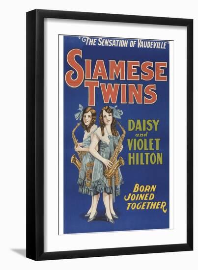 Siamese Twins--Framed Art Print