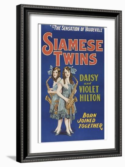 Siamese Twins-null-Framed Art Print