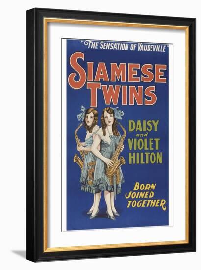 Siamese Twins-null-Framed Art Print