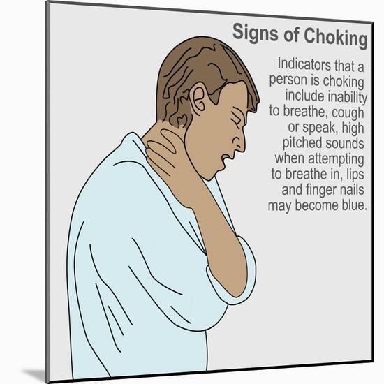 Signs of Choking-Gwen Shockey-Mounted Giclee Print