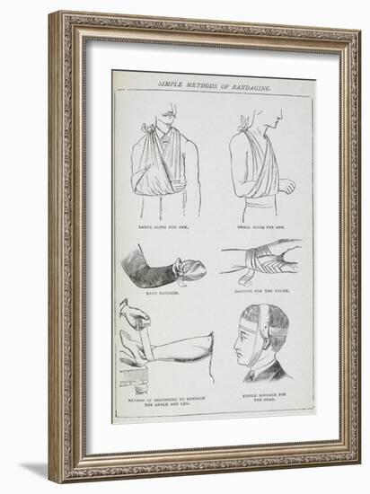 Simple Methods Of Bandaging-Isabella Beeton-Framed Giclee Print