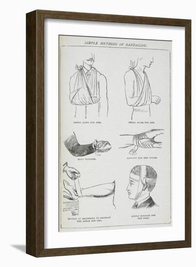 Simple Methods Of Bandaging-Isabella Beeton-Framed Giclee Print