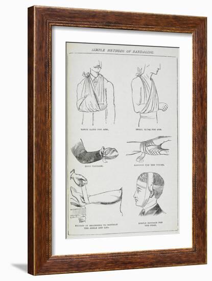 Simple Methods Of Bandaging-Isabella Beeton-Framed Giclee Print