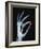 Skeletal Hand Holding Computer Chip-Charles O'Rear-Framed Photographic Print