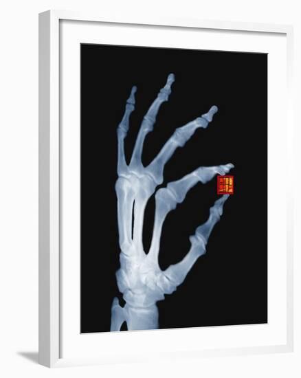 Skeletal Hand Holding Computer Chip-Charles O'Rear-Framed Photographic Print