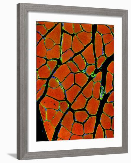 Skeletal Muscle Fibres, Light Micrograph-Thomas Deerinck-Framed Photographic Print