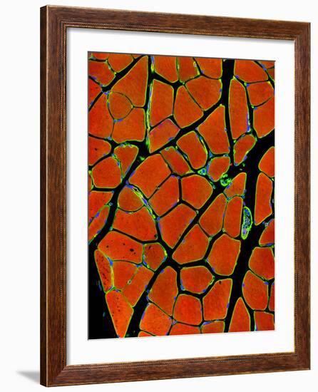 Skeletal Muscle Fibres, Light Micrograph-Thomas Deerinck-Framed Photographic Print