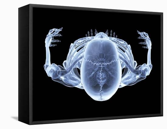 Skeleton From Above, X-ray Artwork-David Mack-Framed Premier Image Canvas