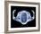 Skeleton From Above, X-ray Artwork-David Mack-Framed Photographic Print