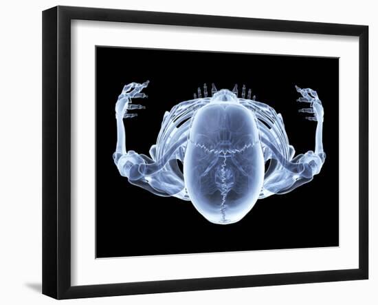 Skeleton From Above, X-ray Artwork-David Mack-Framed Photographic Print