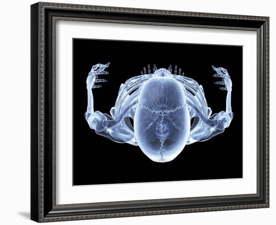 Skeleton From Above, X-ray Artwork-David Mack-Framed Photographic Print
