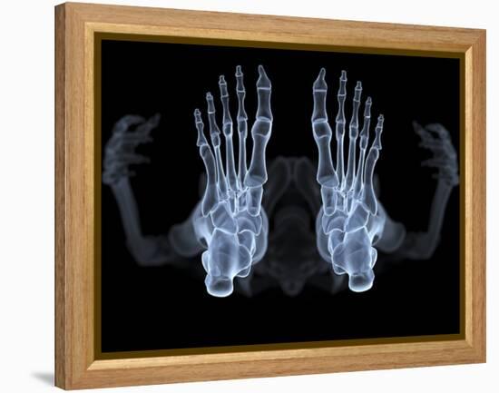 Skeleton From Below, X-ray Artwork-David Mack-Framed Premier Image Canvas