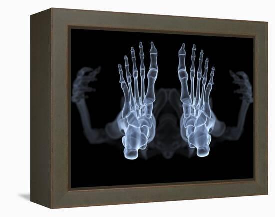 Skeleton From Below, X-ray Artwork-David Mack-Framed Premier Image Canvas