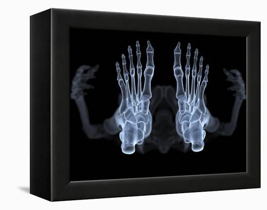 Skeleton From Below, X-ray Artwork-David Mack-Framed Premier Image Canvas