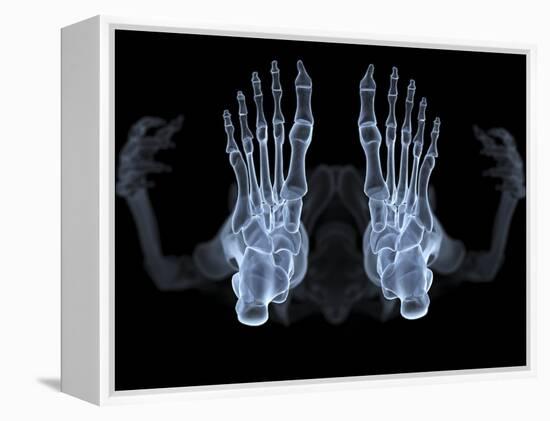 Skeleton From Below, X-ray Artwork-David Mack-Framed Premier Image Canvas