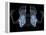 Skeleton From Below, X-ray Artwork-David Mack-Framed Premier Image Canvas