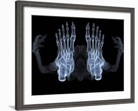 Skeleton From Below, X-ray Artwork-David Mack-Framed Photographic Print