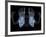 Skeleton From Below, X-ray Artwork-David Mack-Framed Photographic Print