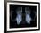 Skeleton From Below, X-ray Artwork-David Mack-Framed Photographic Print