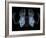 Skeleton From Below, X-ray Artwork-David Mack-Framed Photographic Print