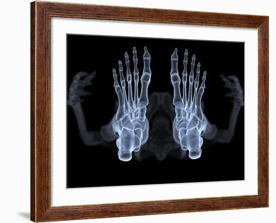 Skeleton From Below, X-ray Artwork-David Mack-Framed Photographic Print