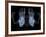 Skeleton From Below, X-ray Artwork-David Mack-Framed Photographic Print