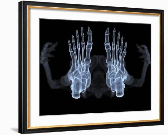 Skeleton From Below, X-ray Artwork-David Mack-Framed Photographic Print